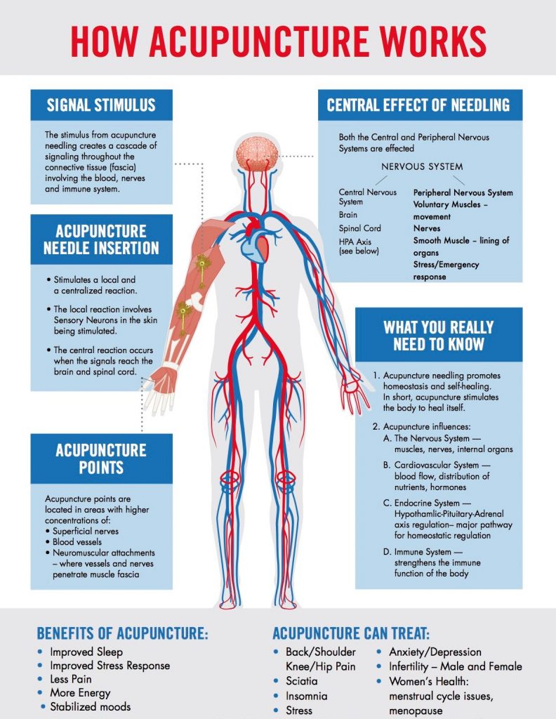 What is Electro-Acupuncture & How Can It Benefit You?